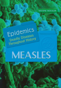 Measles