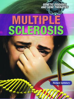 Multiple Sclerosis