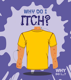 Why Do I Itch?