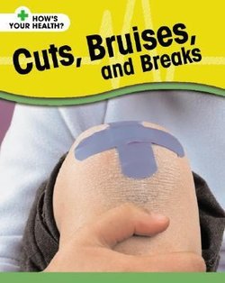 Cuts, Bruises, and Breaks