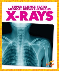 X-Rays